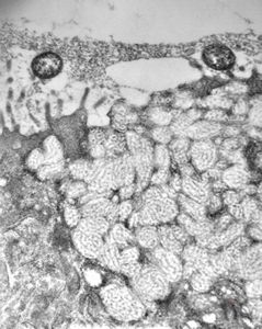 M,82y. | Helicobacter pylori - antrum ventriculi M,82y. | Helicobacter pylori - antrum ventriculi